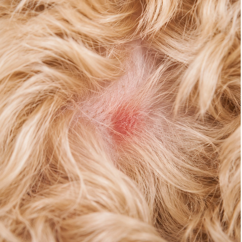 Skin needs ongoing care